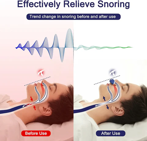 Micro CPAP Sleep Apnoea Machine for Travel & Anti-Snoring