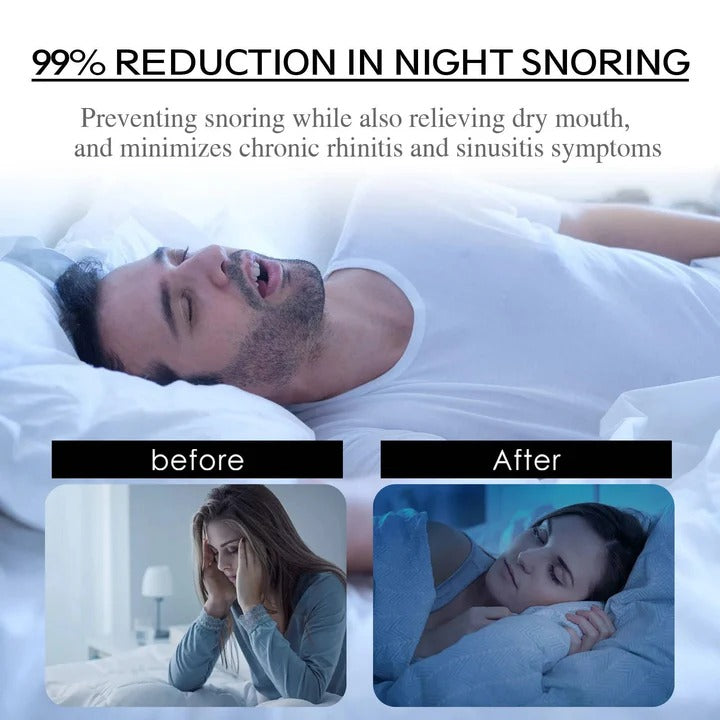 Sleep Mouth Tape for Nasal Breathing Support