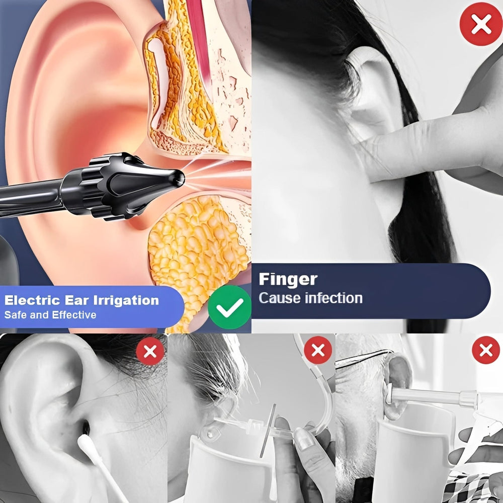Water-Based and USB Rechargeable Ear Rinsing Device