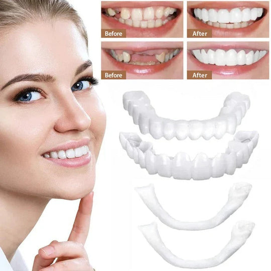Clip-On Cosmetic Veneers and Temporary Tooth Covers
