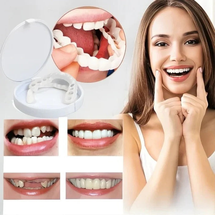 Clip-On Cosmetic Veneers and Temporary Tooth Covers