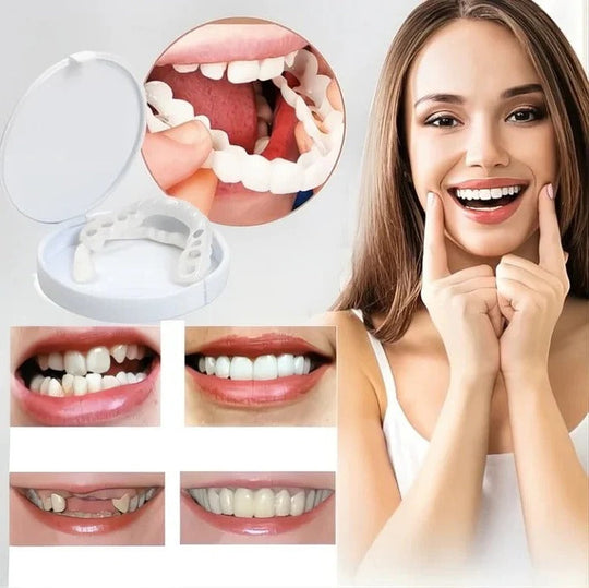 Clip-On Cosmetic Veneers and Temporary Tooth Covers