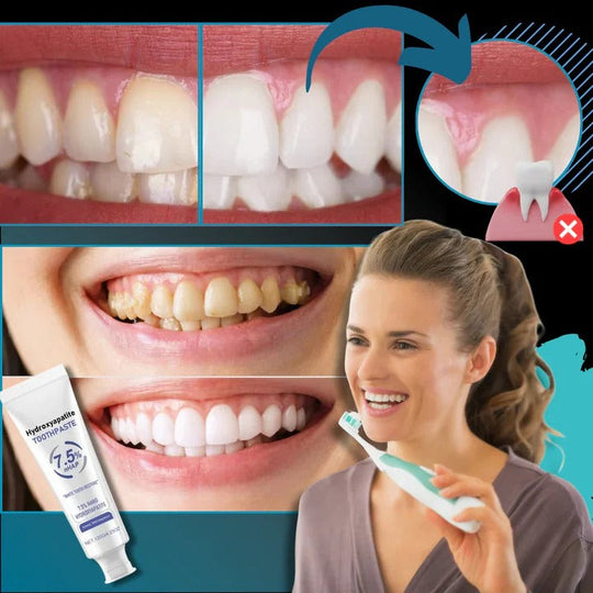 Nano Hydroxyapatite Toothpaste for Low Abrasive Brushing