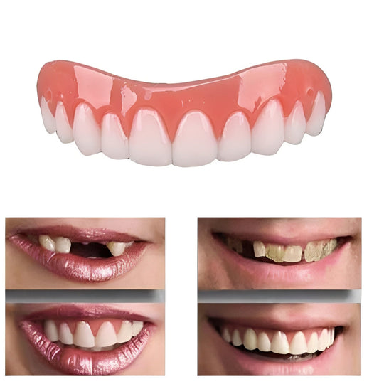 Reusable Artificial Tooth Veneer for Short Term Cosmetic Wear