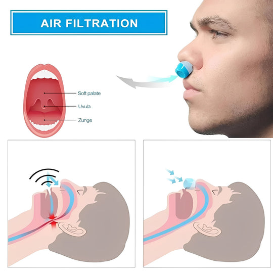 Cordless Nasal Sleep Aid Device, Compact Snoring Support Insert