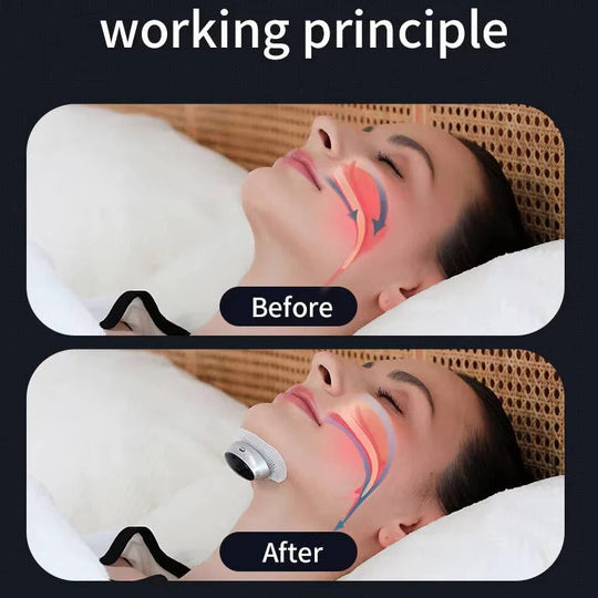 Snoring Support Device with Automatic Stimulation Adjustment