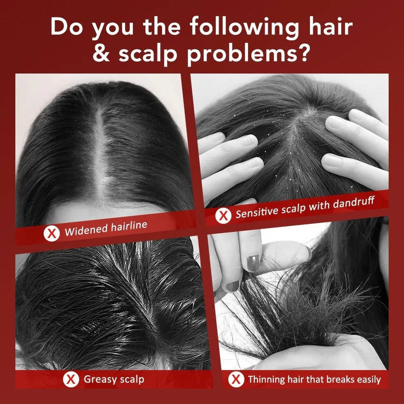 Scalp Massage Brush with Red Light for Hair Support