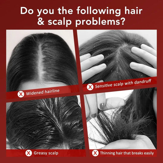 Scalp Massage Brush with Red Light for Hair Support