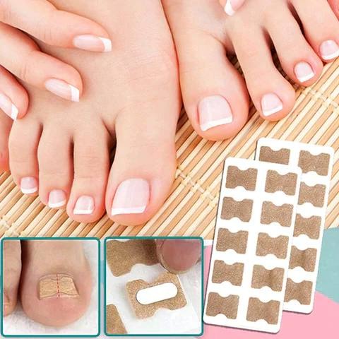 Adhesive Nail Support Strips for Curved Nails and Daily Nail Care