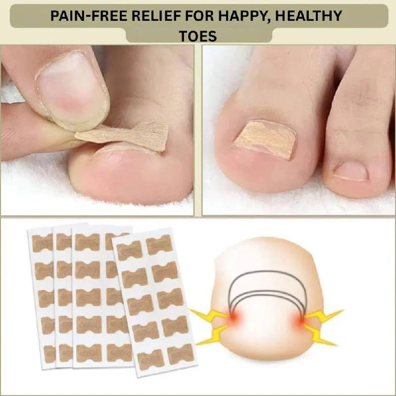 Adhesive Nail Support Strips for Curved Nails and Daily Nail Care
