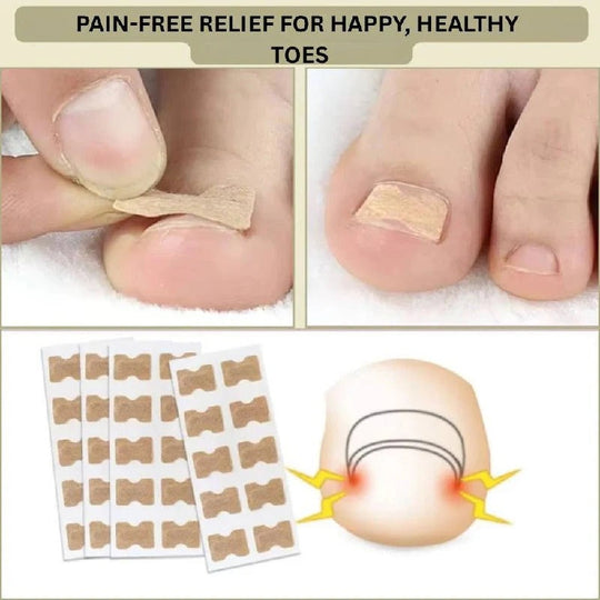 Adhesive Nail Support Strips for Curved Nails and Daily Nail Care