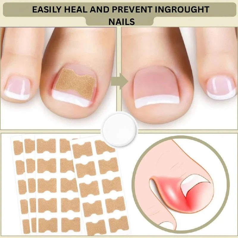 Adhesive Nail Support Strips for Curved Nails and Daily Nail Care