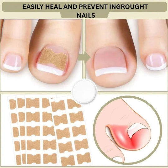 Adhesive Nail Support Strips for Curved Nails and Daily Nail Care