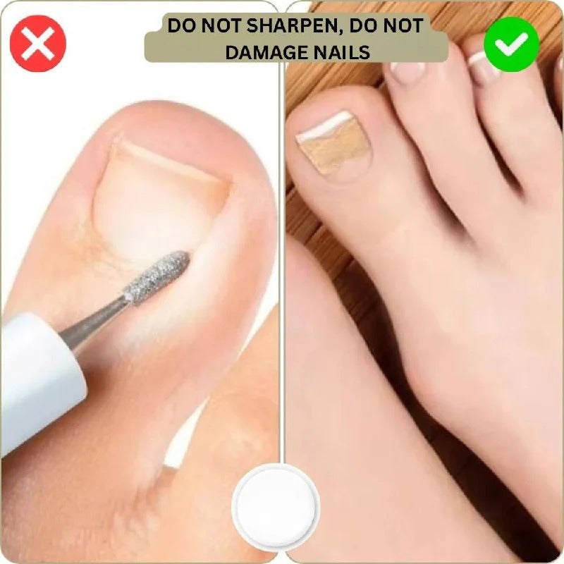 Adhesive Nail Support Strips for Curved Nails and Daily Nail Care