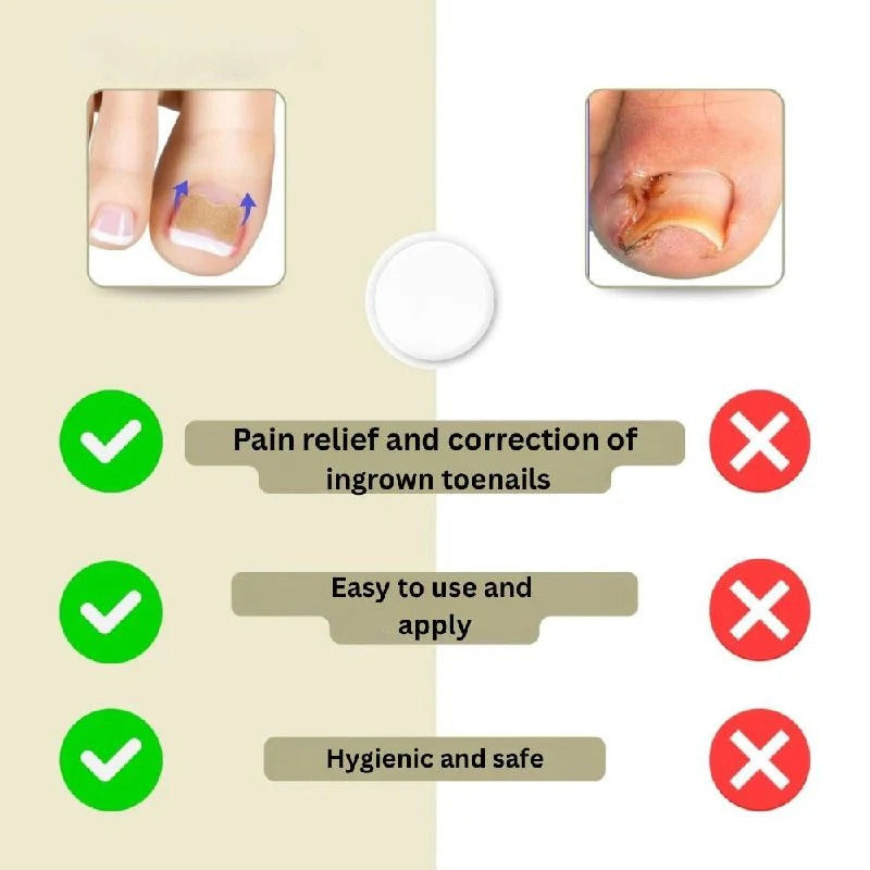 Adhesive Nail Support Strips for Curved Nails and Daily Nail Care