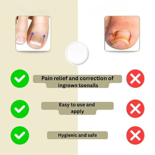 Adhesive Nail Support Strips for Curved Nails and Daily Nail Care