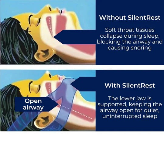 Chin Strap for Snoring and Sleep Support