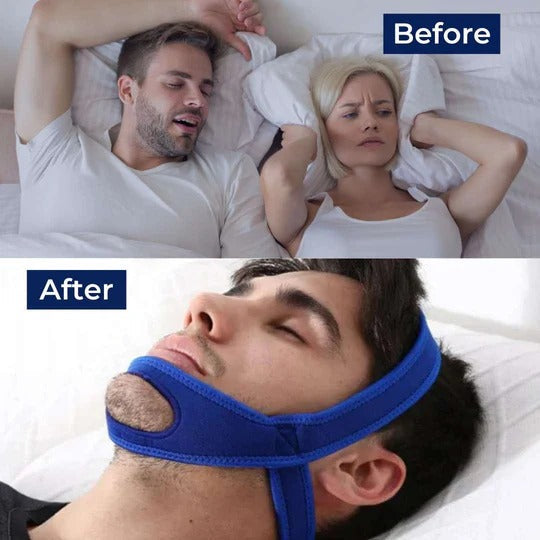 Chin Strap for Snoring and Sleep Support
