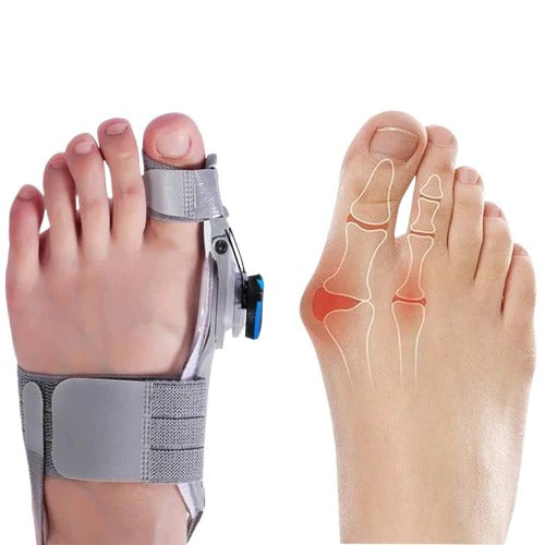 Adjustable Toe Spacer for Foot Alignment Support
