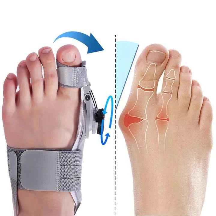 Adjustable Toe Spacer for Foot Alignment Support