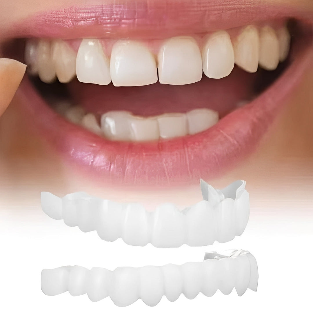 Snap-On Cosmetic Tooth Covers for Adults, 2 Piece Set