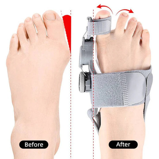 Adjustable Toe Spacer for Foot Alignment Support