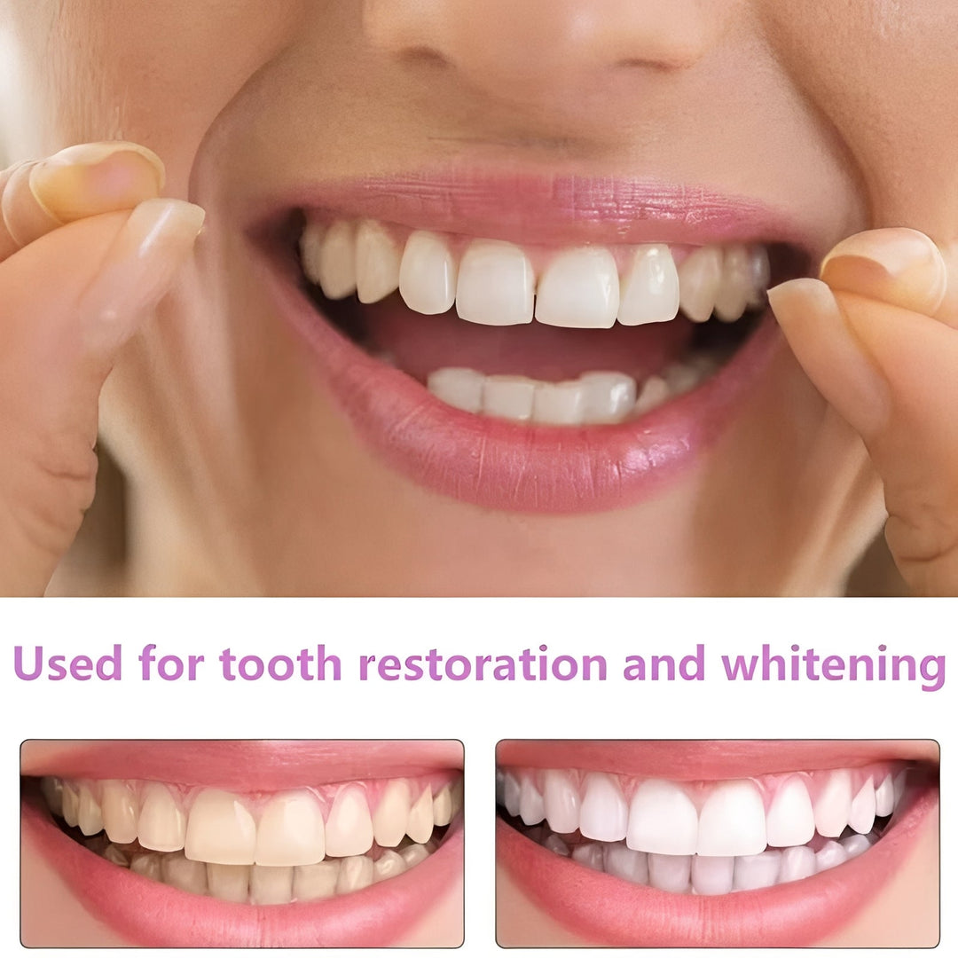 Snap-On Cosmetic Tooth Covers for Adults, 2 Piece Set