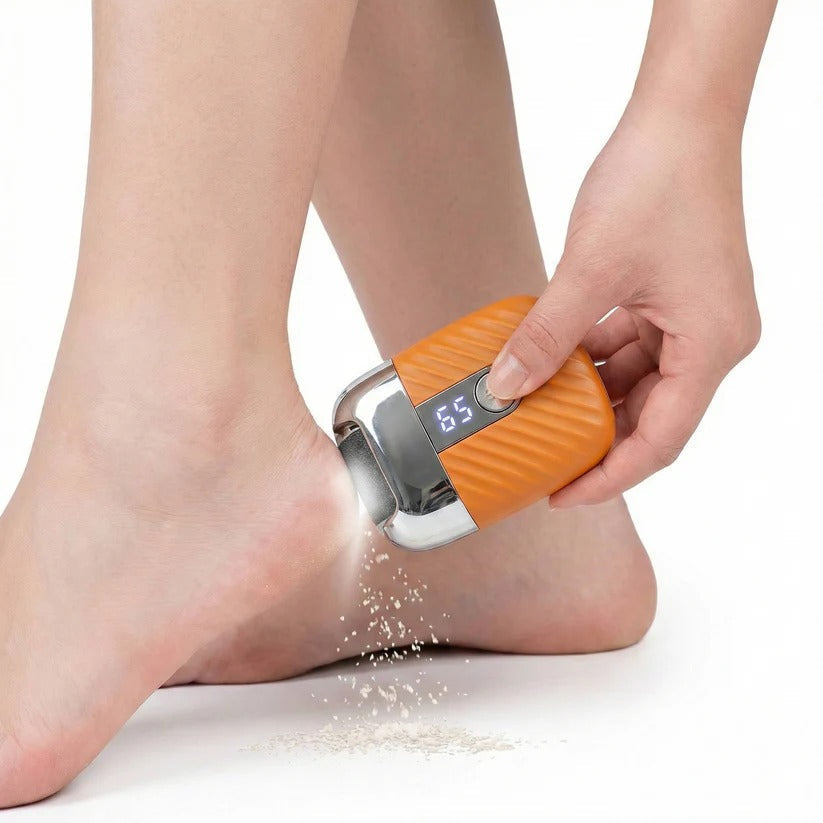 USB Rechargeable Electric Foot File with 3 Interchangeable Grinding Heads, Dual Speed and LED Light