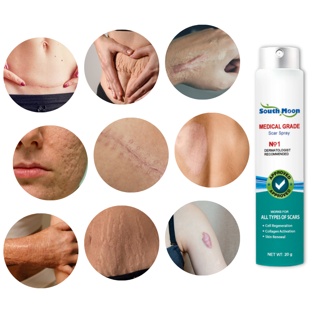 Scar Removal Spray Treatment