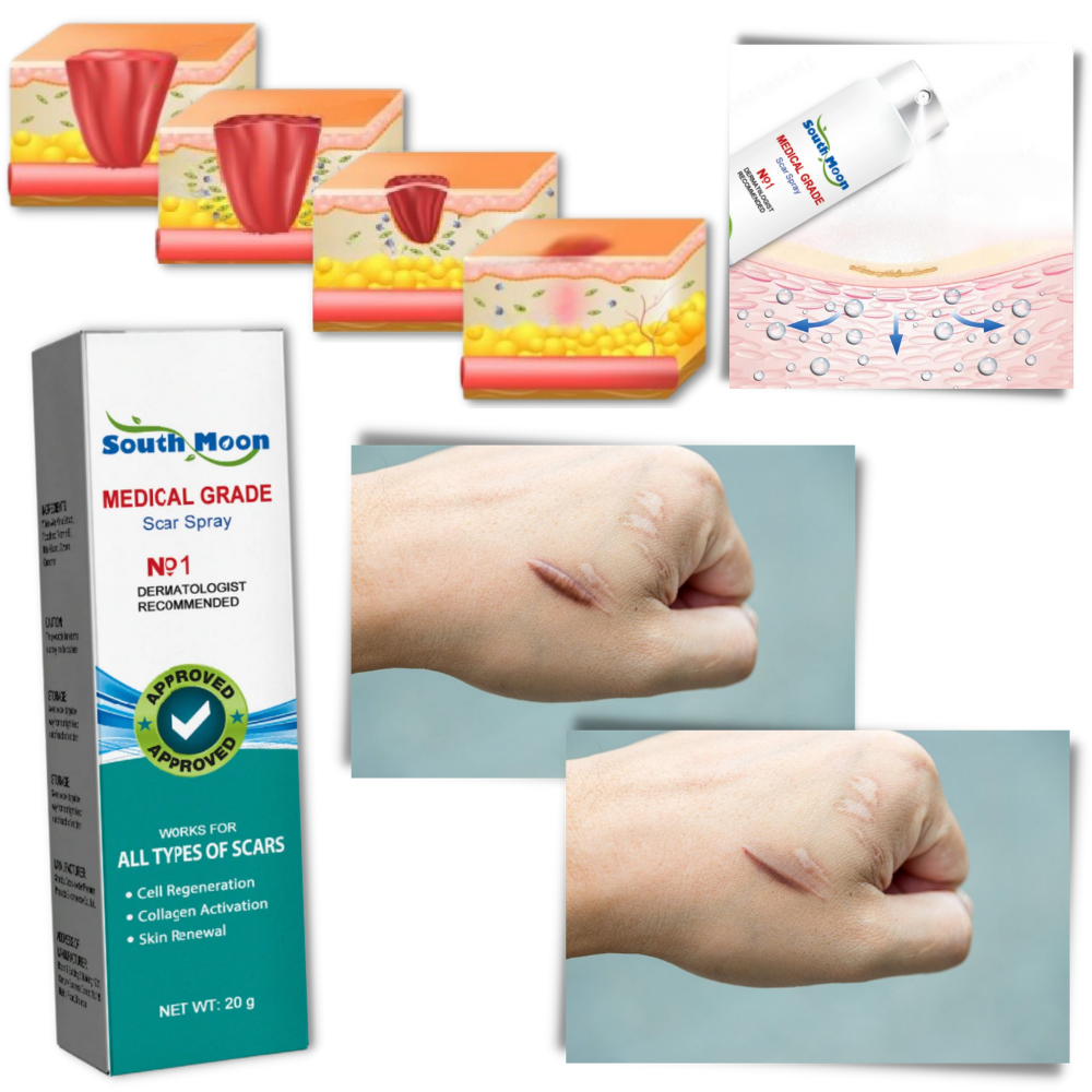 Scar Removal Spray Treatment