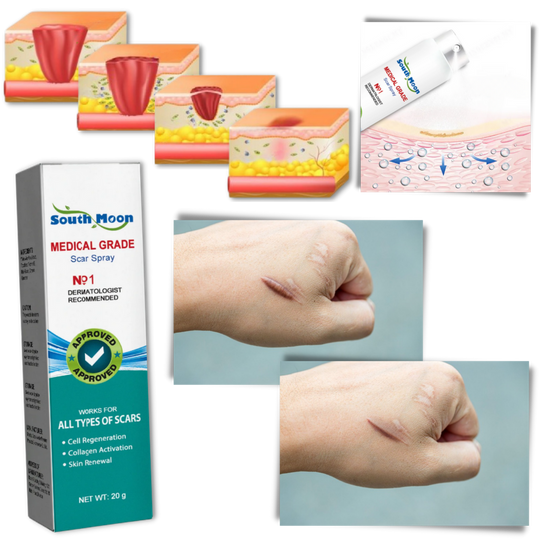 Scar Removal Spray Treatment