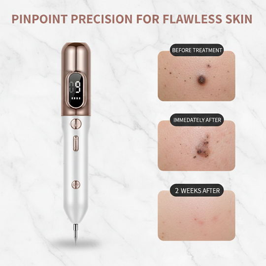 Plasma Pen - Adjustable Levels - Handheld Device